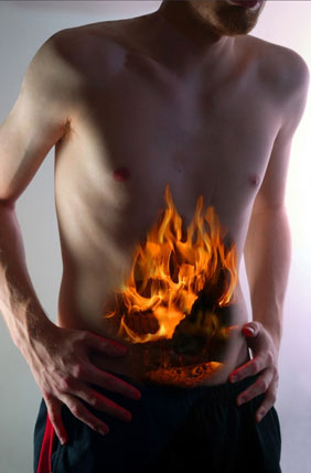 Irritable Bowel Syndrome - Lifeline